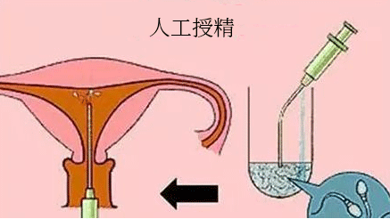 保障试管婴儿成功率需要注意哪些事项？