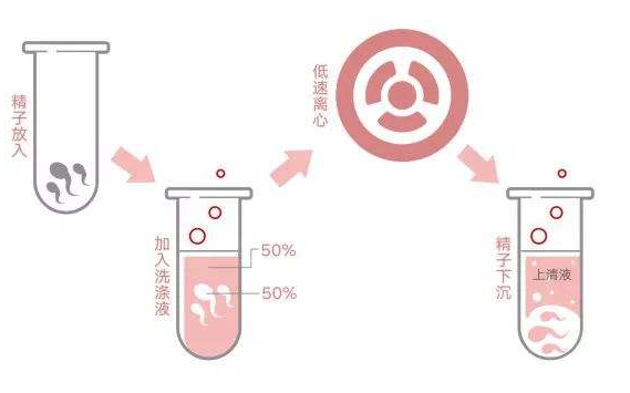 洗精术是怎么回事?步骤流程有哪些？