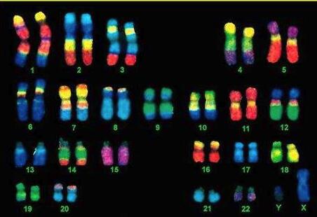 做试管婴儿为什么要做染色体检查