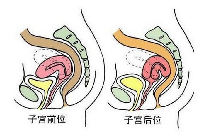 女性子宫后位是什么意思影响怀孕吗