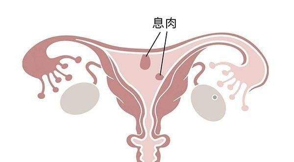 卵巢功能应该做什么检查