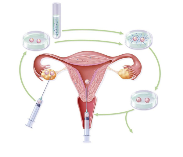 卵巢功能不好的症状表现有哪些