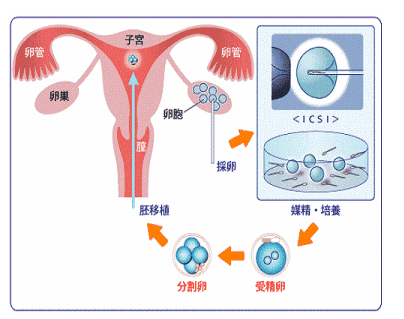 子宫肌瘤早期有什么明显症状