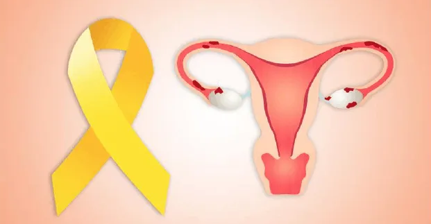 如何判断女性卵巢好不好？这三项检查非常重要！
