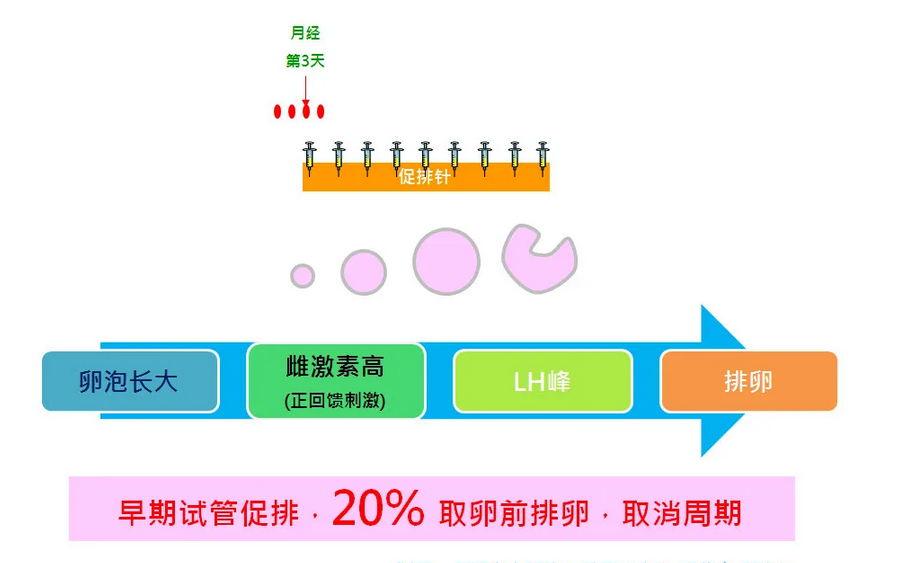 试管拮抗剂方案优点缺点