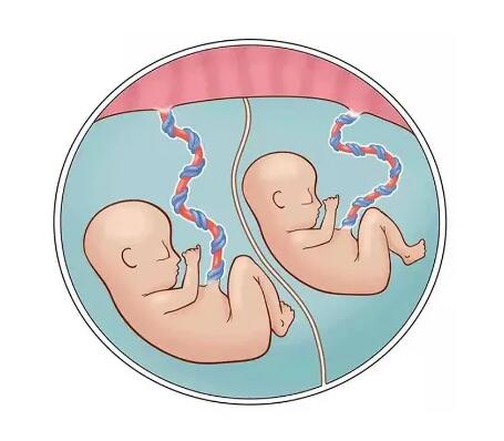 试管受孕双胞胎的概率有多大