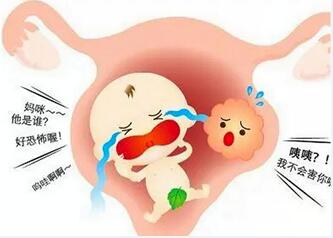 宫腔环境不好会影响胎儿正常发育吗?宫腔环境不好的五大影响!