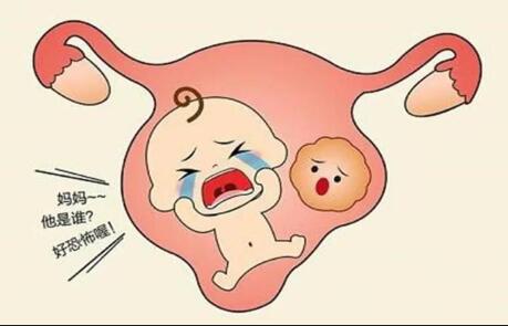 始基子宫想做试管婴儿需要哪些条件?是什么原因导致了始基子宫?