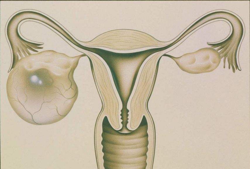 女性四十岁卵巢衰退怎么办?这些方法可以缓解!