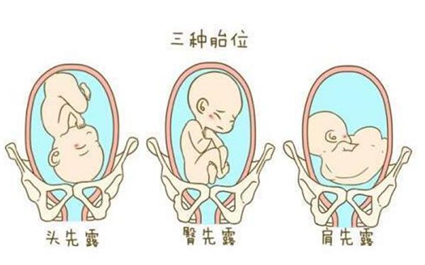 备孕夫妻提高怀双胞胎几率的方法有哪些?
