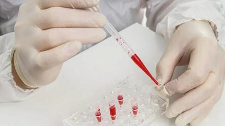 女性剖腹产后多久能做供卵试管婴儿? 