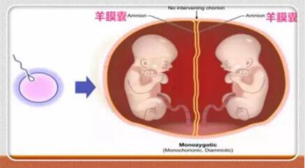 双胎妊娠和单胎妊娠有什么区别?双胞胎和单胎哪个更好?