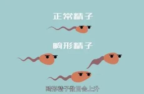 精子成活率低怀孕后会导致胎儿畸形吗?