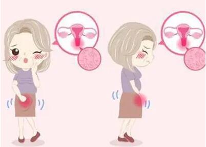 怎么区分月经痛和怀孕痛?经痛和怀孕痛的区别!