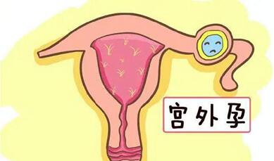 如何判断是不是宫外怀孕?宫外孕一般有3个典型症状!