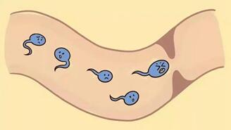 男人备孕期间如何改善精子质量?五大方法不容无视!