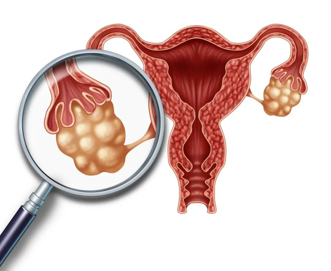 卵巢好不好身体异常暗示卵巢病变