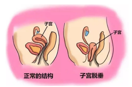 子宫内膜0.5cm正常吗?