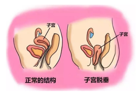 子宫内膜0.5cm正常吗？