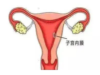 子宫内膜多少毫米是正常的