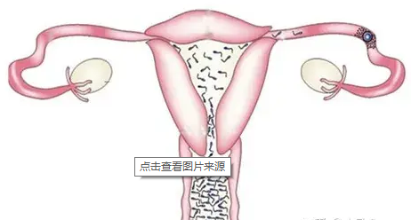 输卵管内径多少mm才正常？