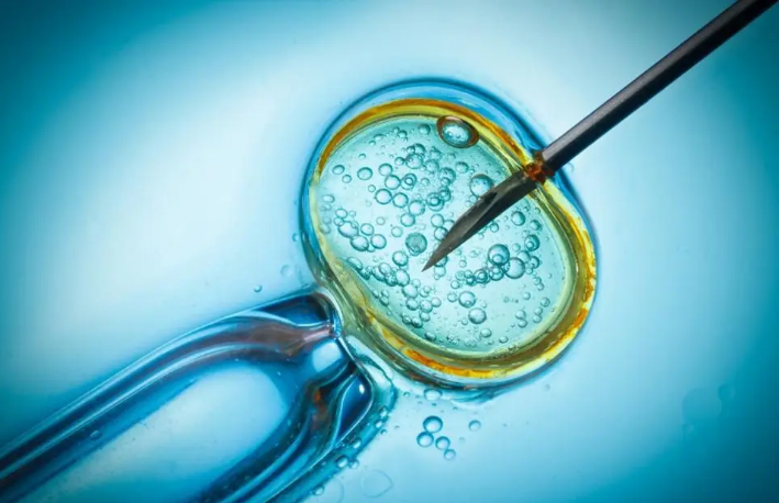 胚胎移植前如何正确憋尿