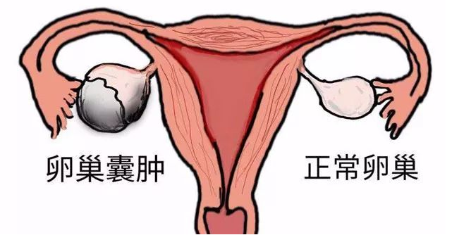 如果卵巢有问题，会出现什么症状