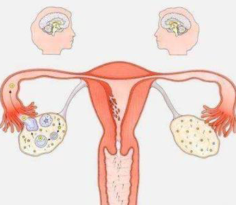 卵巢表现不佳该怎么办