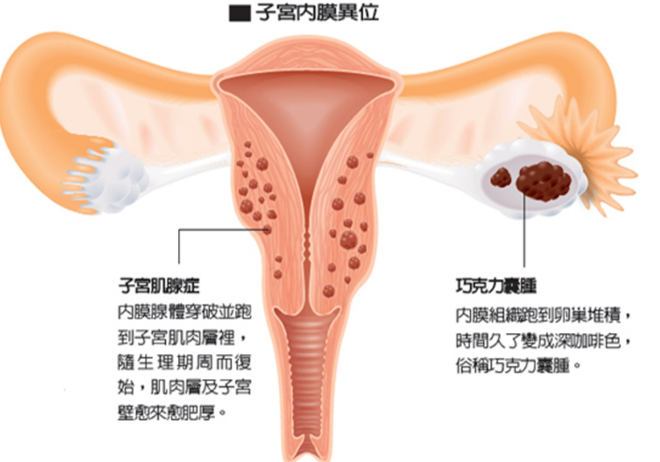 输卵管阻塞的原因是什么
