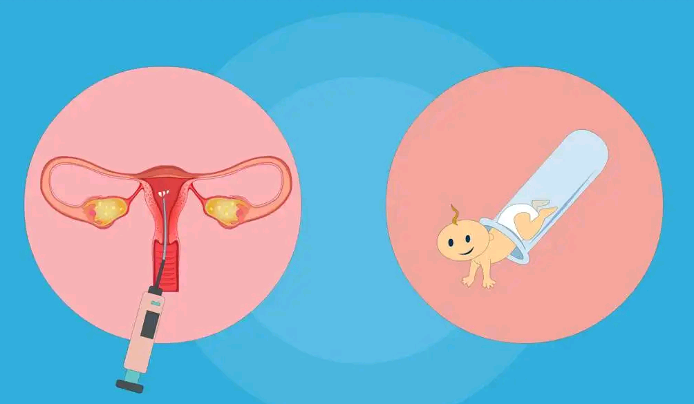 卵巢囊肿，能做试管婴儿吗？