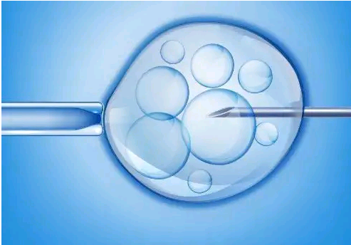 什么是囊胚活检