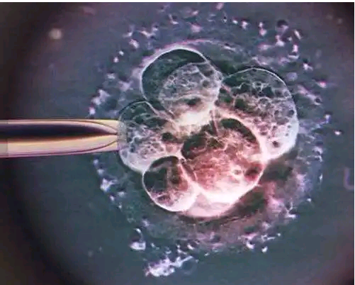 冷冻胚胎移植的最佳内膜厚度是多少