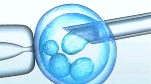 冷冻胚囊胚更容易成为男孩吗