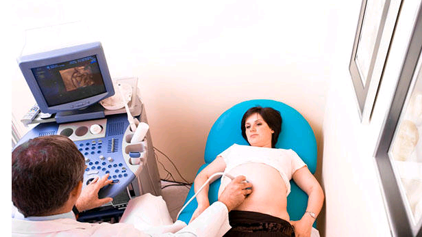 宫外孕b超单确诊图片